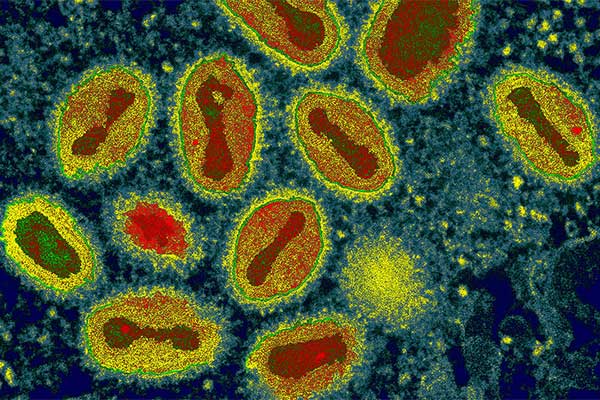 Poxvirus Penyebab Jerawat di Alat Kelamin