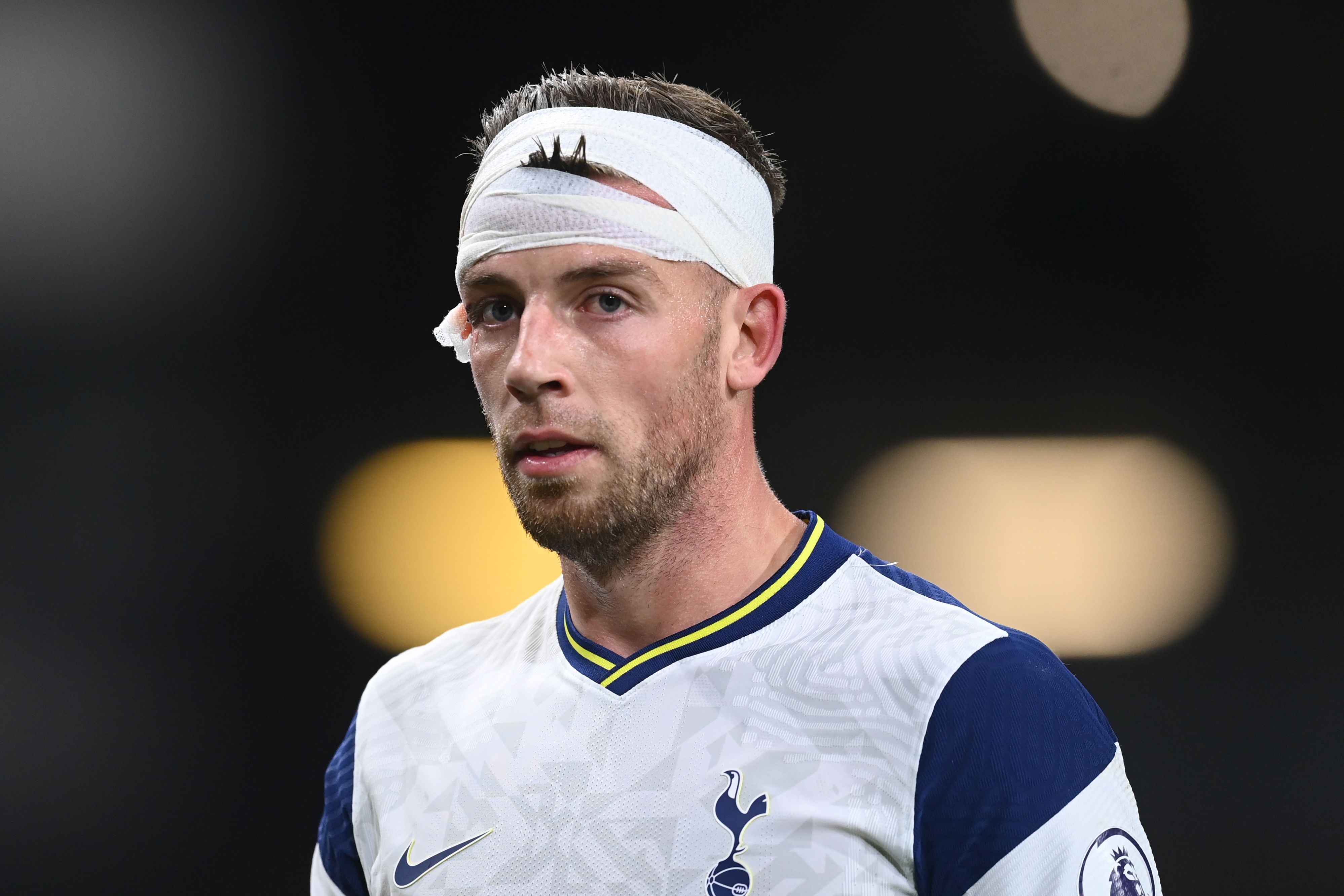 Cedera, Alderweireld Harus Absen Empat Pekan