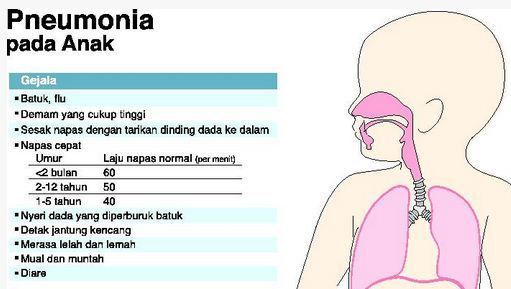 Penyakit pneumonia pada anak dan gejalanya.