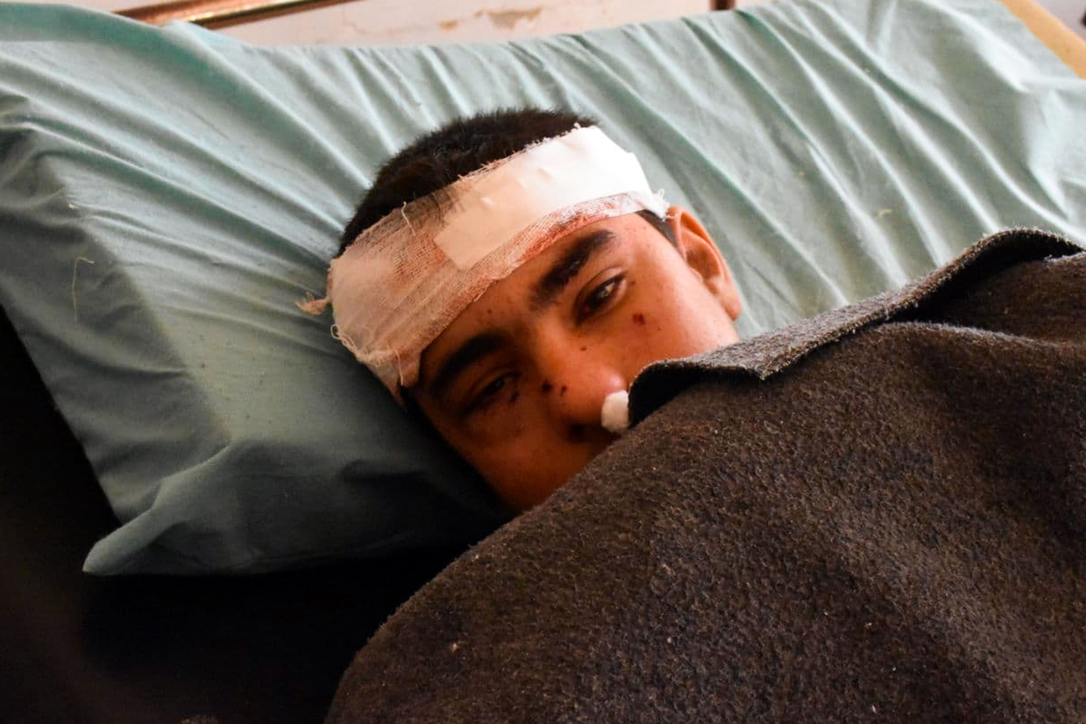 Seorang anak laki-laki yang terluka terbaring di ranjang rumah sakit menyusul laporan serangan Israel di Provinsi Hama, Suriah, pekan lalu. 