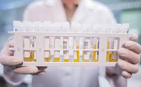 Ilustrasi: plasma konvalesen