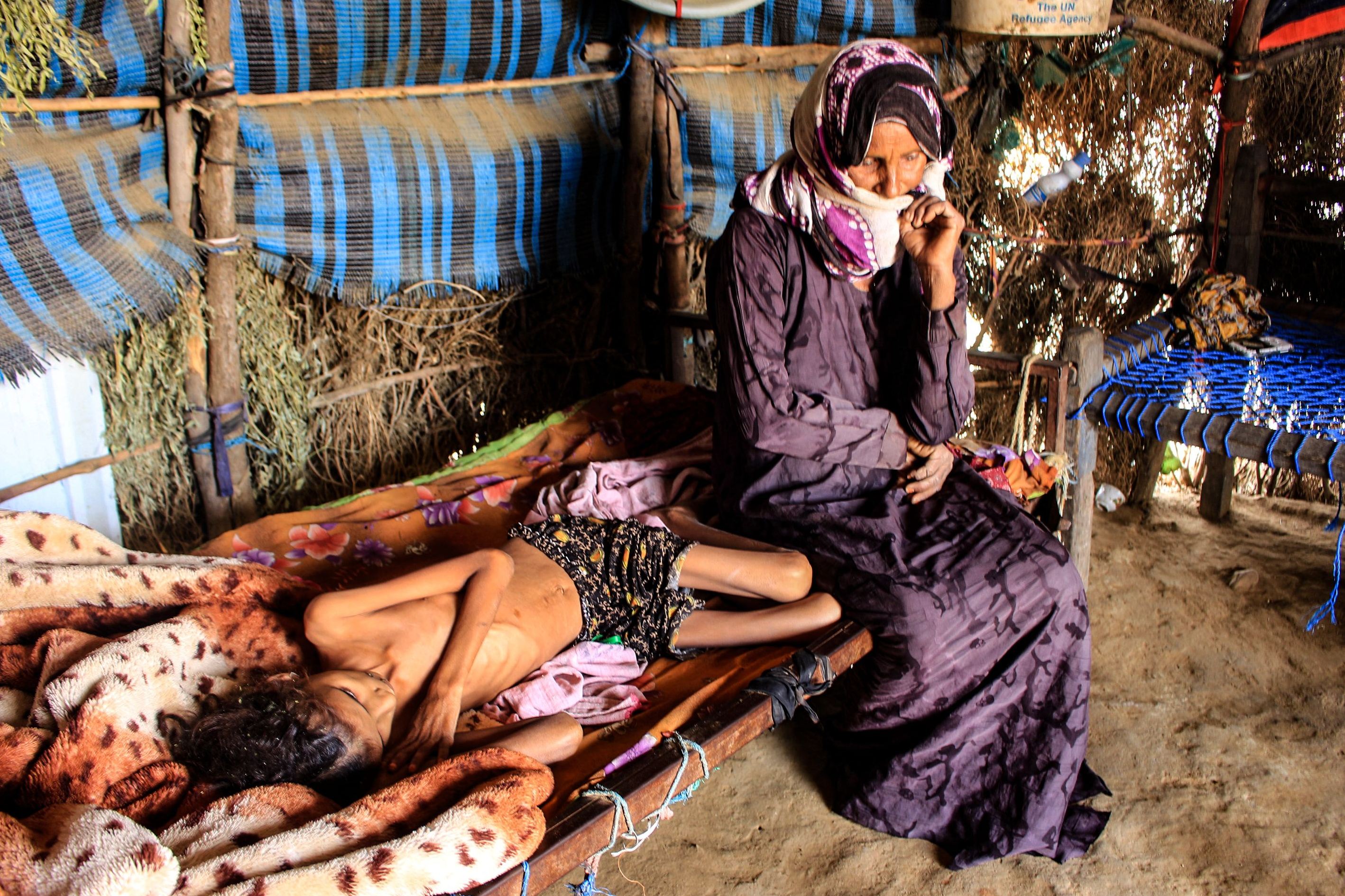 PBB: 400.000 Anak di Yaman Terancam Meninggal akibat Kelaparan