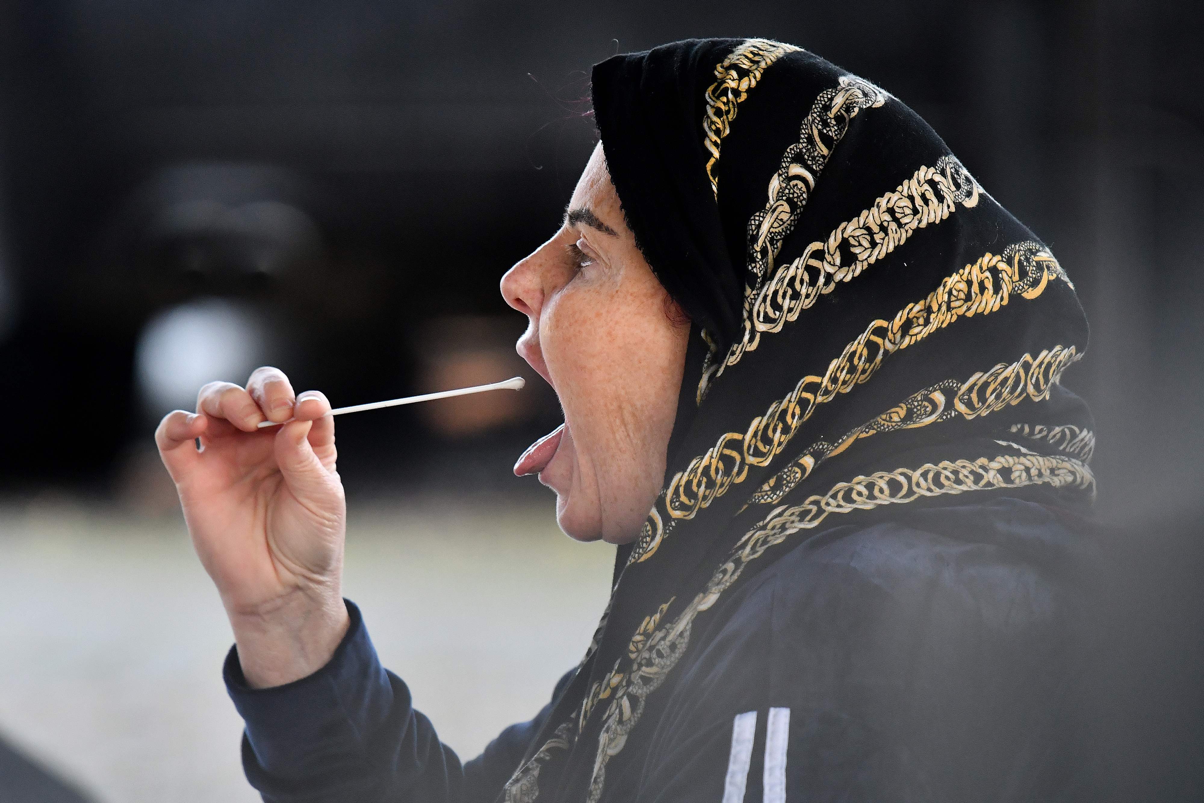 Kenali Gejala Baru Covid Tongue