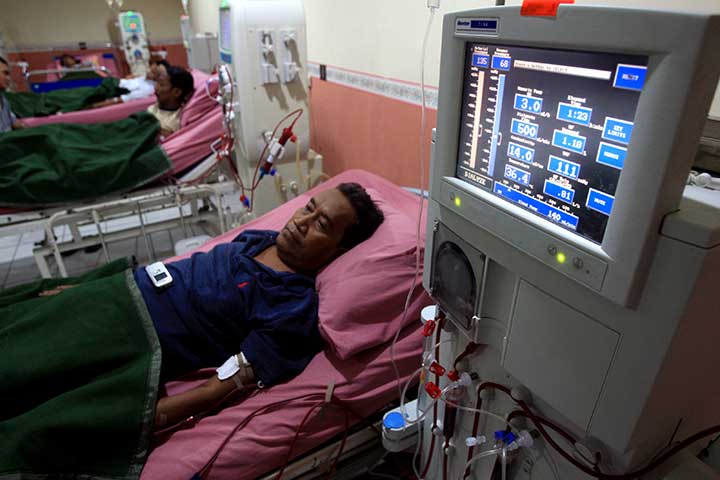 Ilustrasi cuci darah.