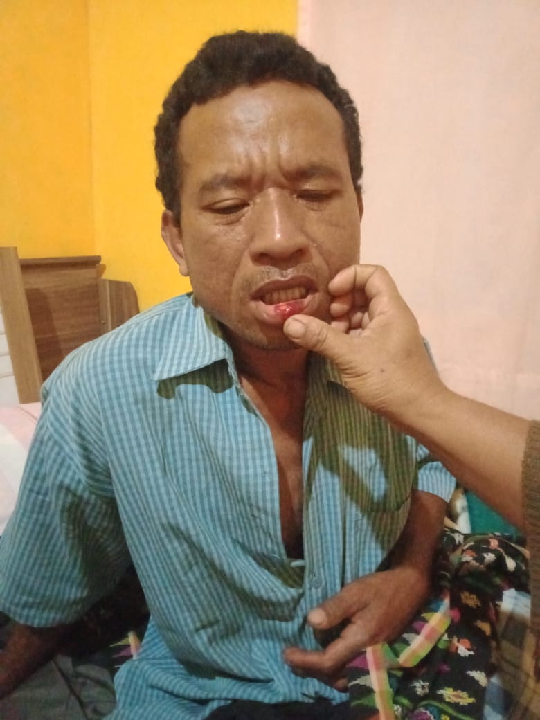 Warga Siri Mese Trauma pada Kekerasan Aparat 