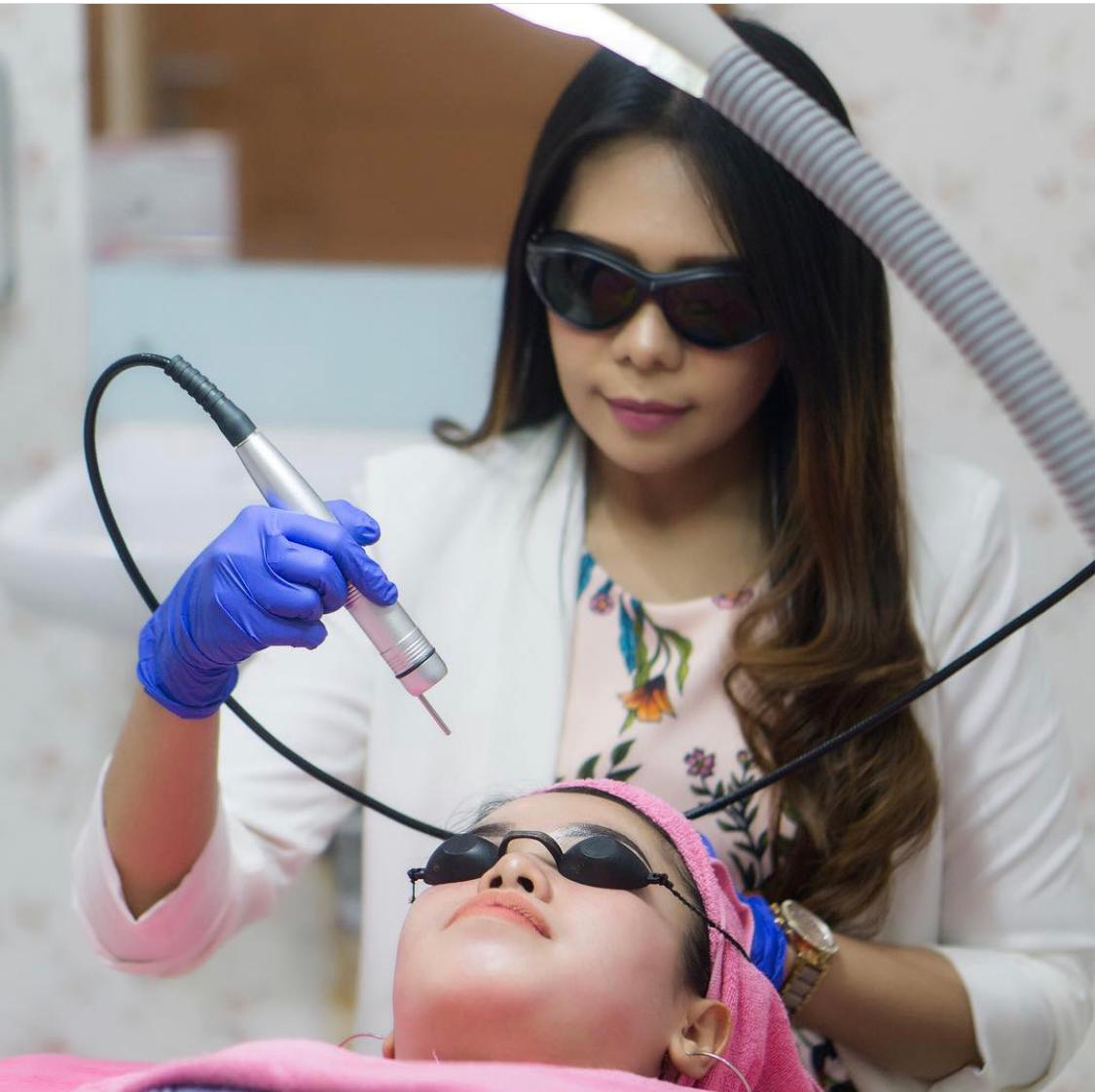 Perawatan laser glowing.