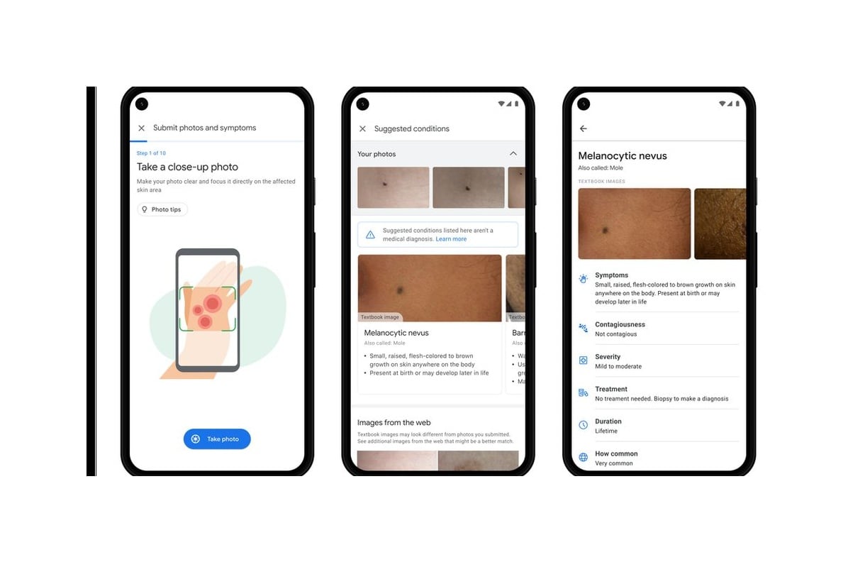 Google kembangkan AI untuk deteksi kondisi kulit, rambut, dan kuku. 