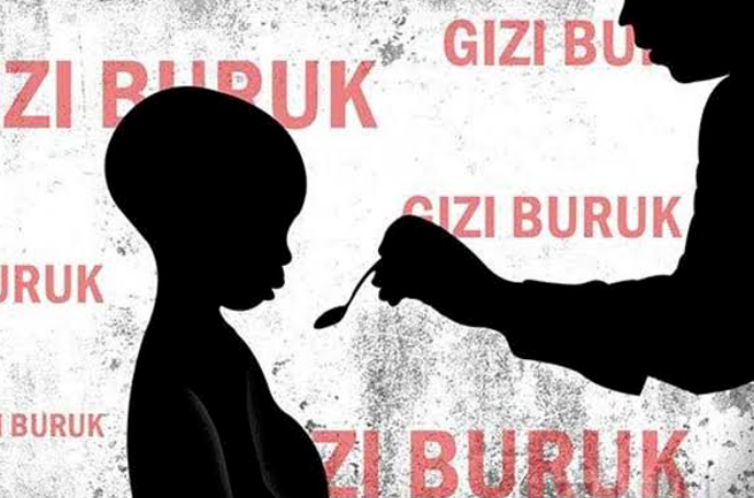 Ilustrasi anak stunting.