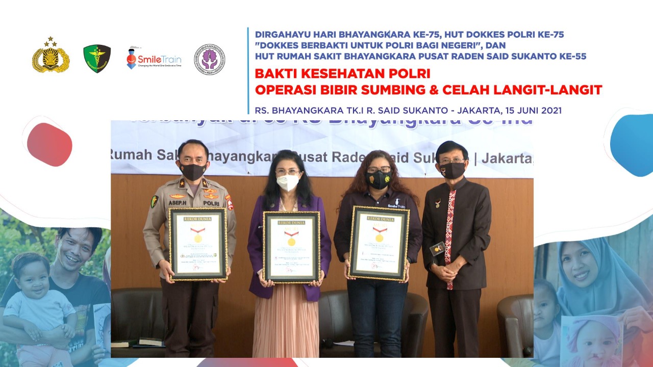 Bakti sosial Operasi Bibir Sumbing digelar serantak di Seluruh RS Bhayangkara meriah penghargaan dari Museum Rekor Dunia-Indonesia (MURI). 