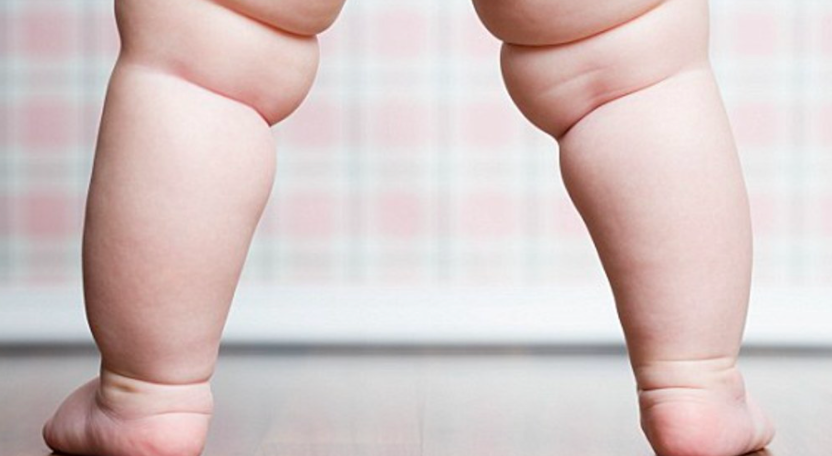 Bayi gendut bisa berisiko patah tulang.