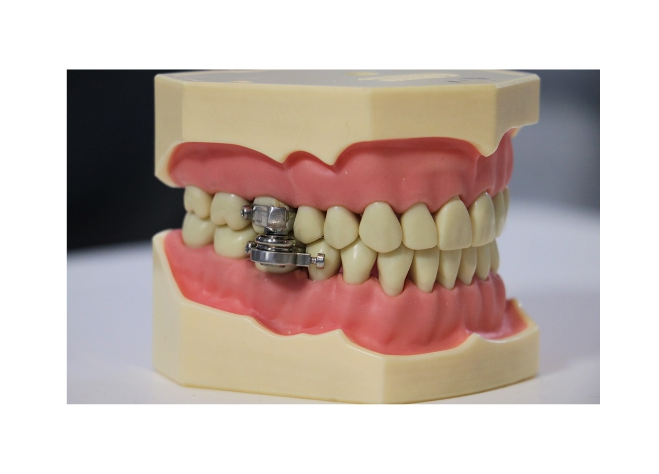 Alat diet yang dinamakan DentalSlim Diet Control