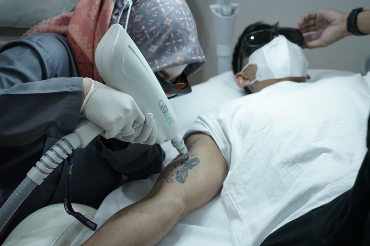 Seorang warga tengah melakukan penghapusan tato.