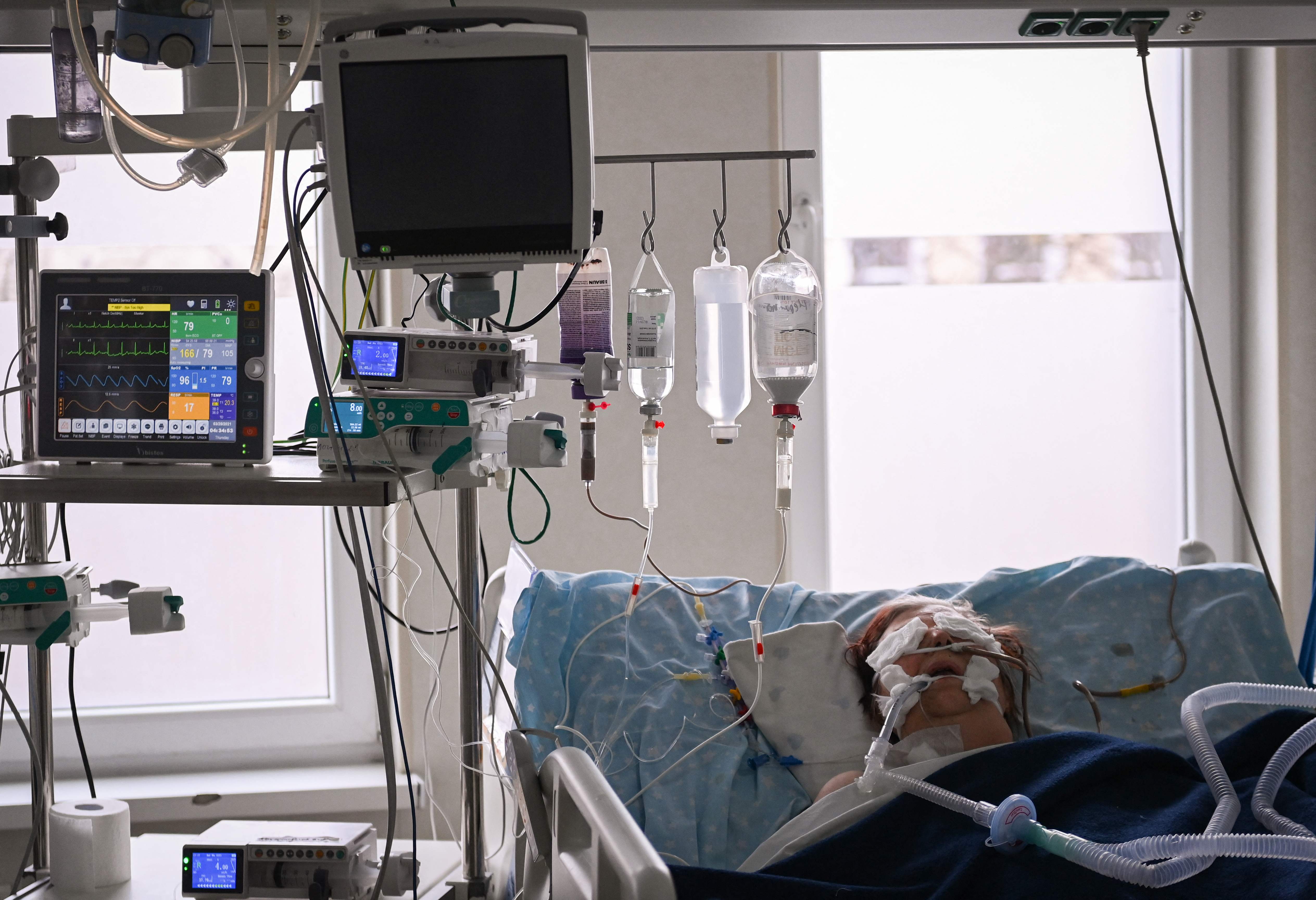 Pasien covid-19 dengan ventilator