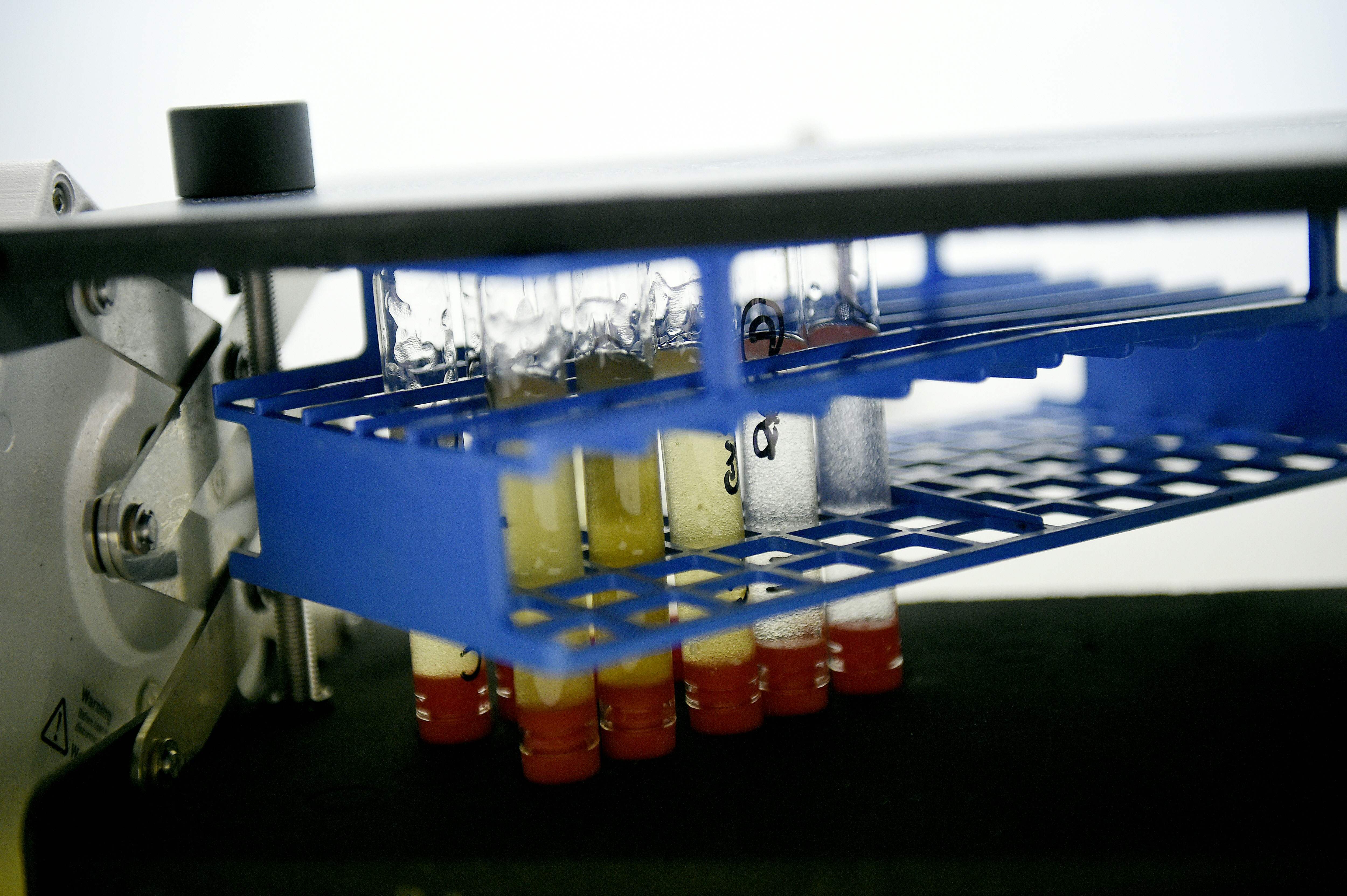 Ilustrasi--Sejumlah sampel urine diuji di laboratorium milik Badan Antidoping Prancis.