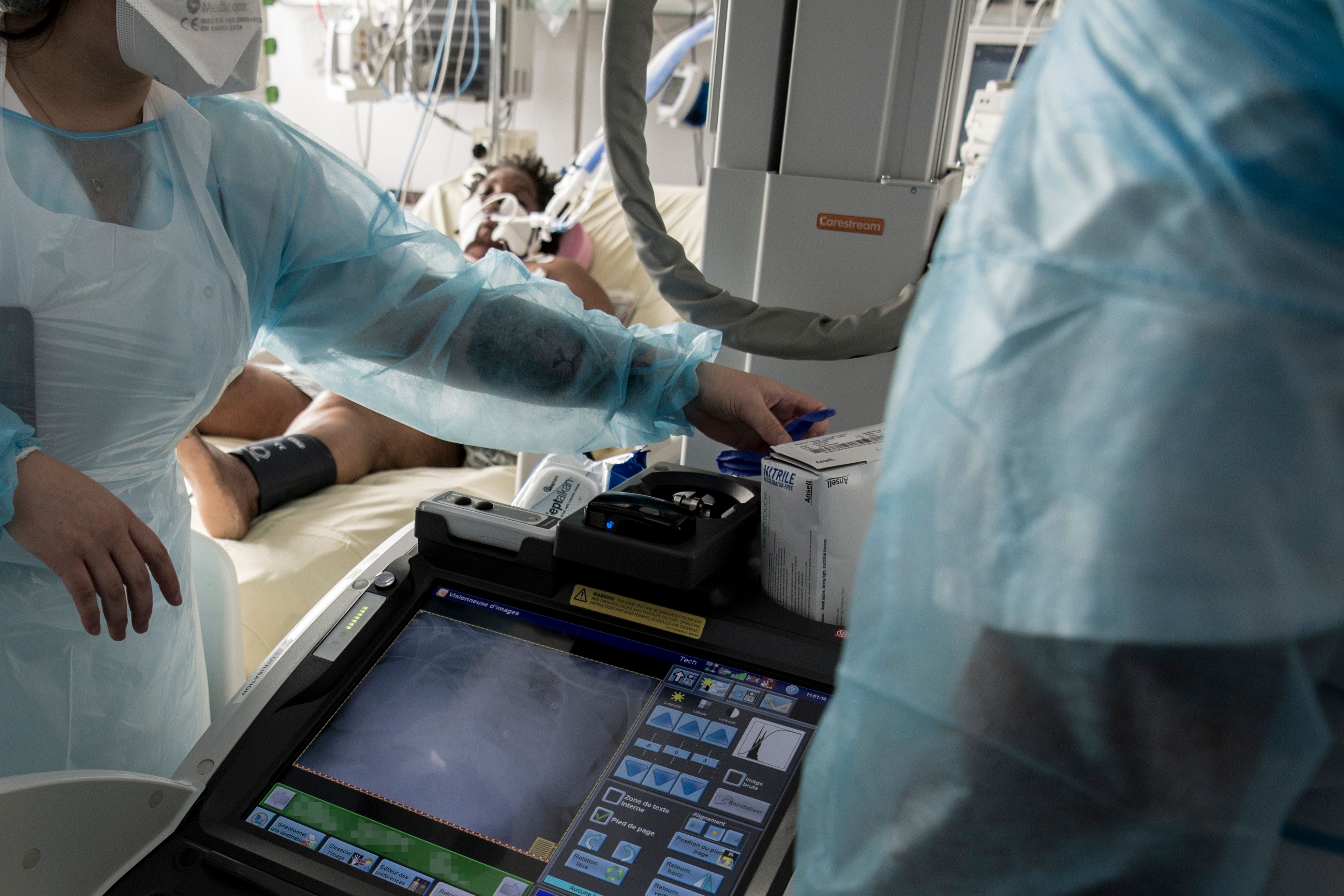 Petugas kesehatan memasang alat radiografi untuk memantau kondisi pasien Covid-19 di ruang ICU di sebuah rumah sakit di Paris, Prancis. 