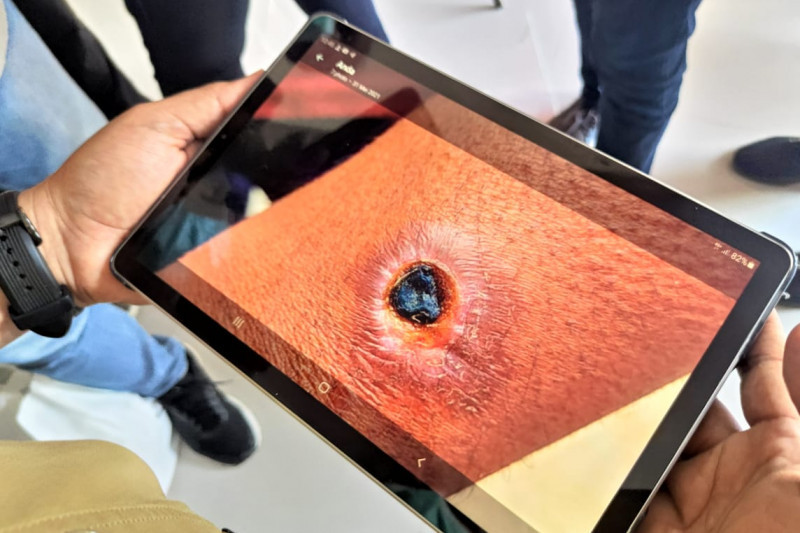  Ilustrasi: Petugas menunjukkan bakteri antraks yang memapar kulit warga 