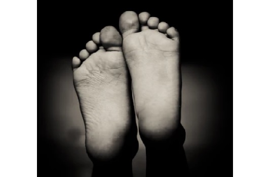 Kaki membusuk terjadi di beberapa pasien covid-19.