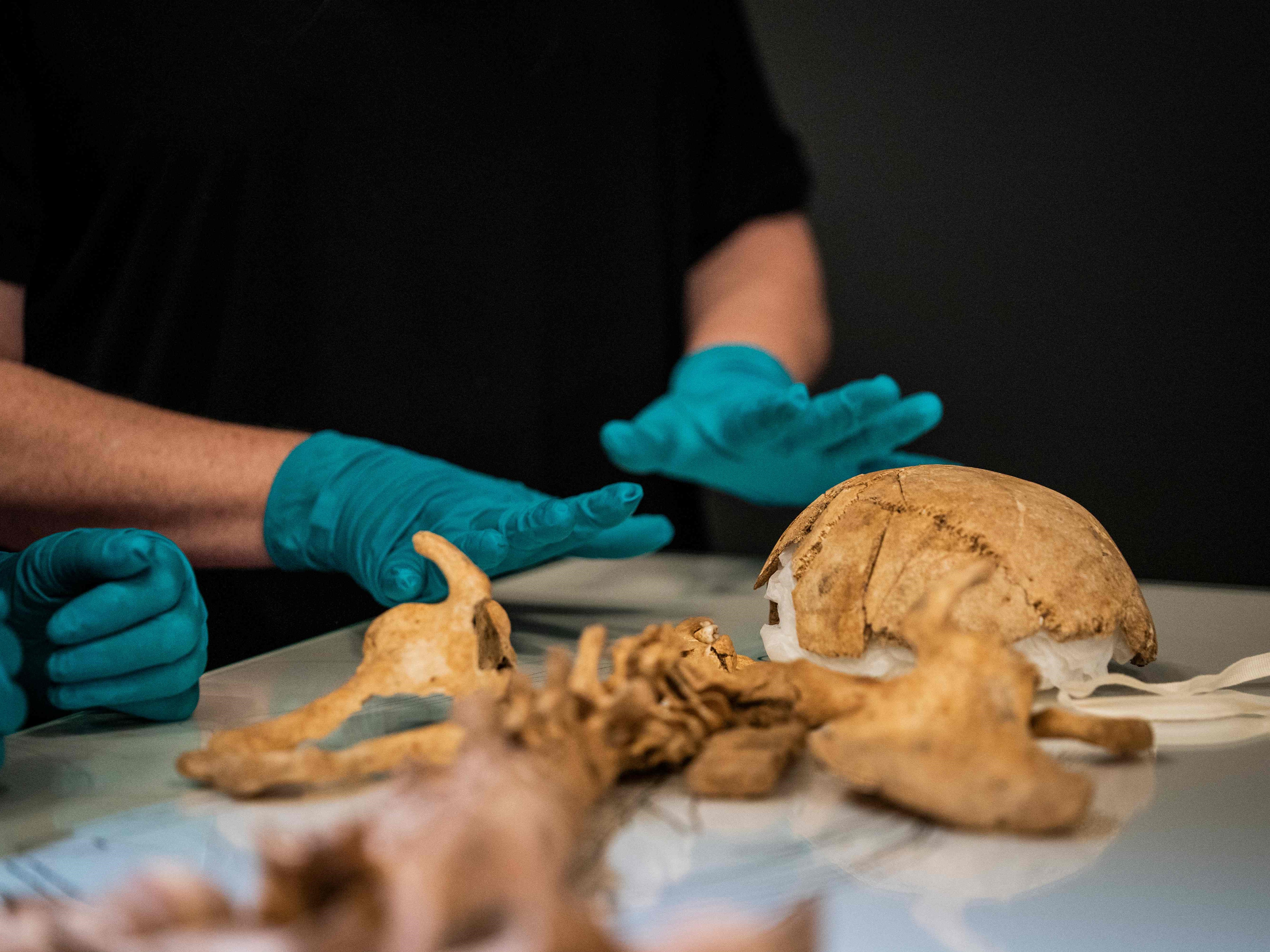 Ilustrasi kerangka manusia.