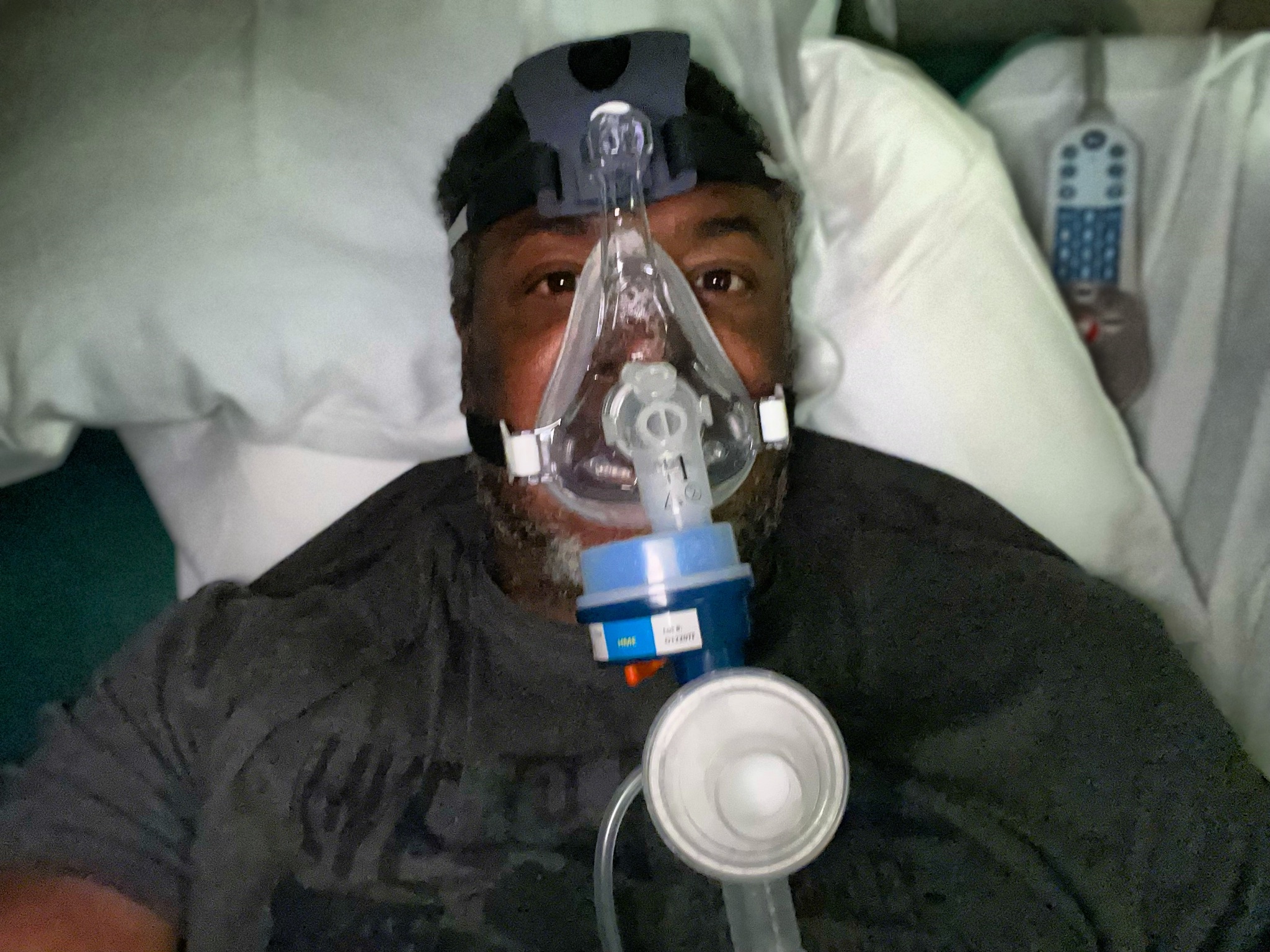 Mantan pemain NBA Cedric Ceballos mengenakan masker oksigen saat dirawat di ICU karena covid-19