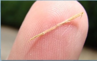 Ini Cara Mudah Mengatasi Kesusupan