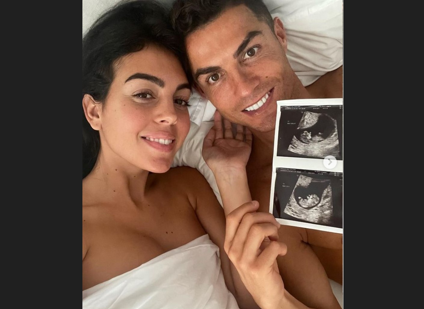Cristiano Ronaldo dan pasangannya Georginia Rodriguez menunjukkan hasil USG.