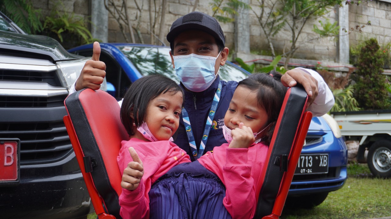 Anak kembar siam Ai Putri Dewi Ningsih dan Ai Putri Anugrah