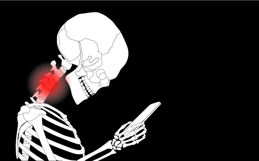 Yuk Mengenal Dislokasi Tulang Leher, Cedera yang Dapat Berakibat Fatal