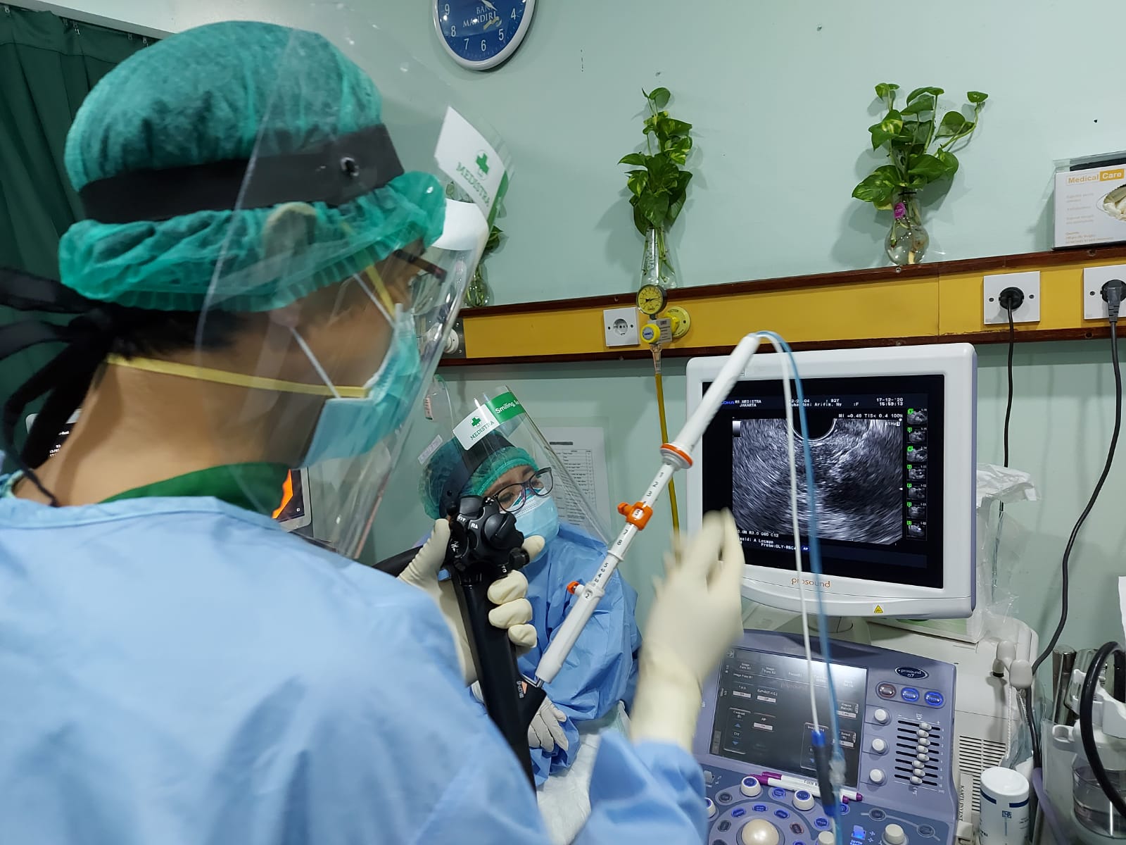 Dokter Spesialis Penyakit Dalam dr. C. Rinaldi Lesmana, Sp.PD-KGEH, tengah melakukan tindakan EUS-RFA pada pasien kanker pankreas.