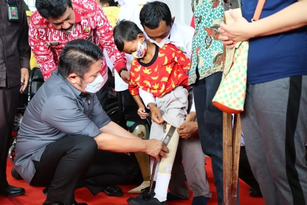 Gubernur Sumatra Selatan Herman Deru membantu seorang anak menggunakan kaki palsu bantuan dari pemerintah provinsi