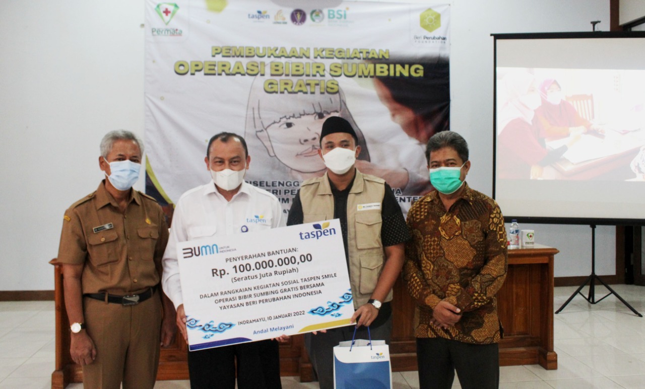 Donasi operasi bibir sumbing dari Taspen