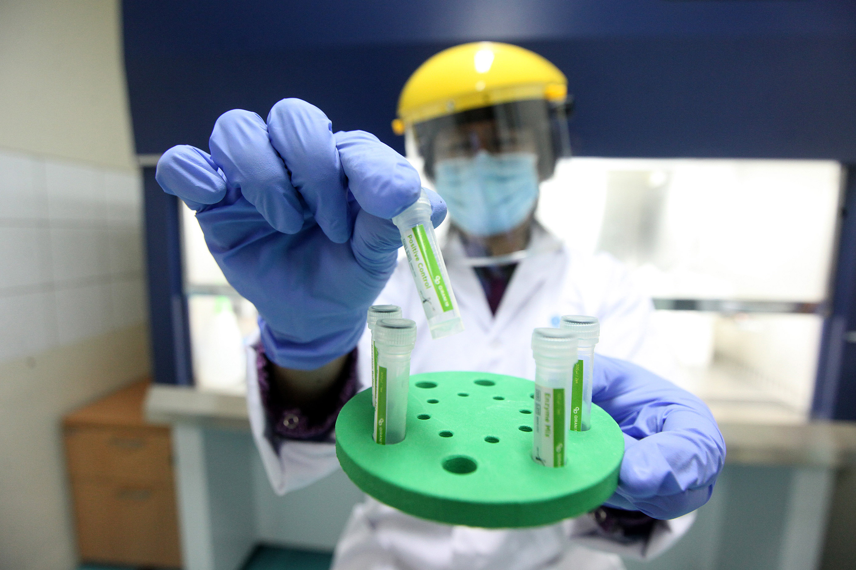 Ilustrasi: Pemeriksaan laboratorium