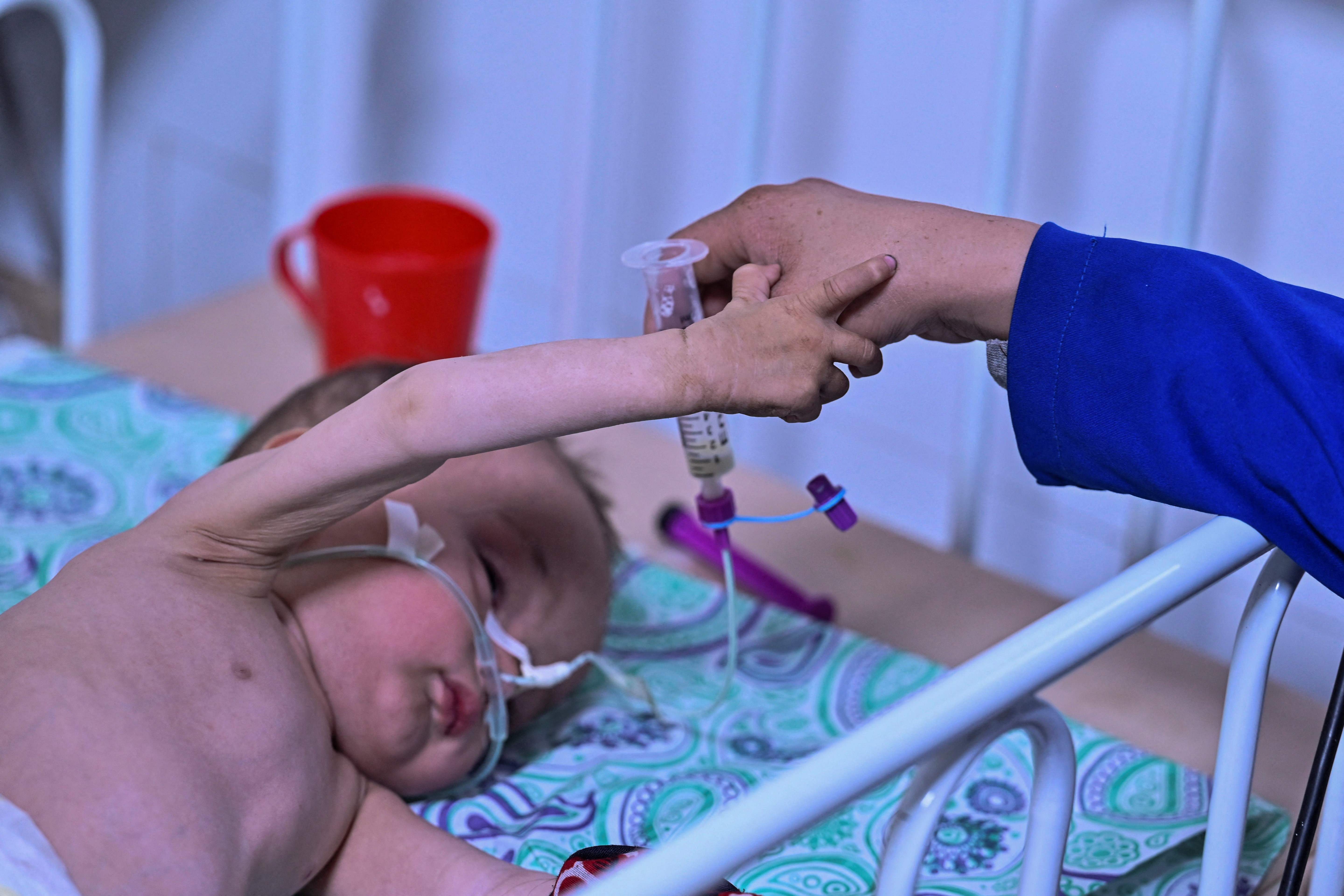 Seorang anak yang kelaparan dirawat di pusat layanan kesehatan Doctors Without Borders (MSF) di Herat, Afghanistan. 