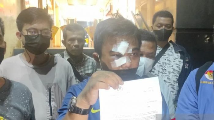 Ketua Umum DPP KNPI Haris Pertama saat melaporkan pengeroyakkannya ke Polda Metro Jaya, Senin malam (21/2/2022)