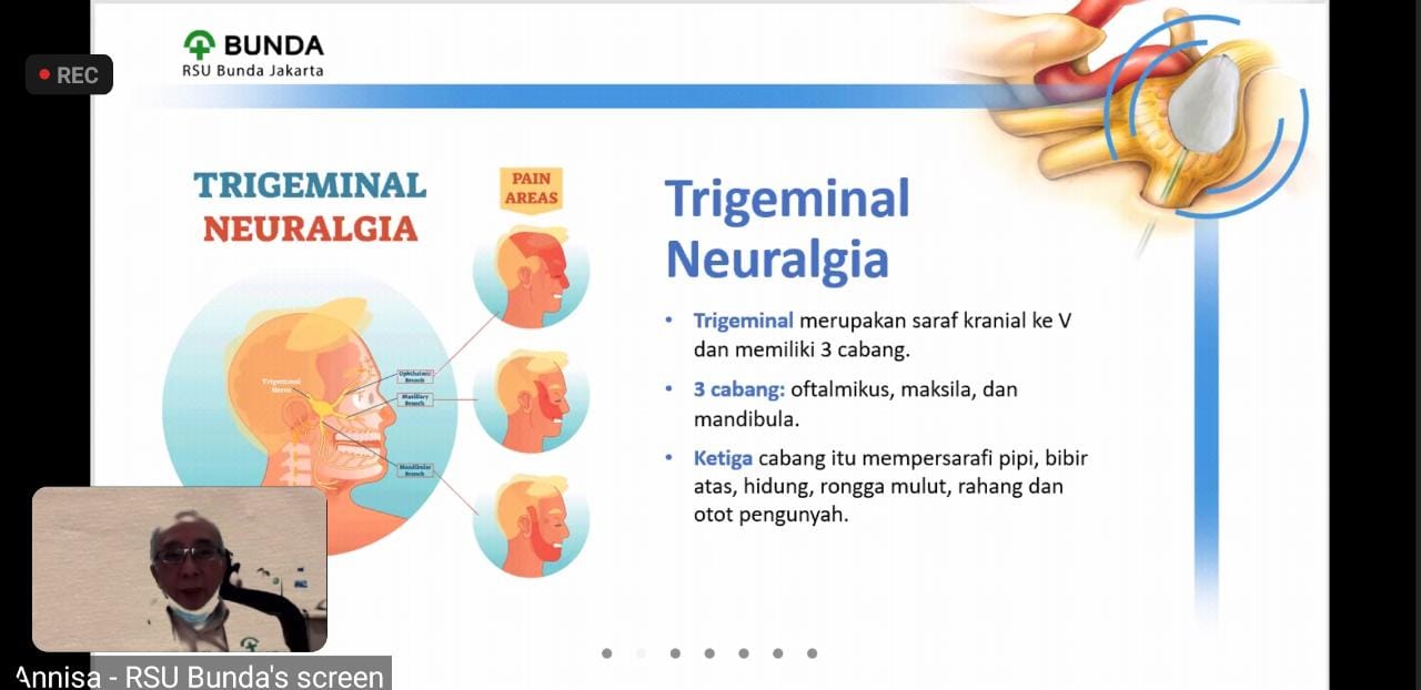 Trigeminal atau saraf trigeminus merupakan saraf kranial ke-V dan memiliki tiga cabang. 