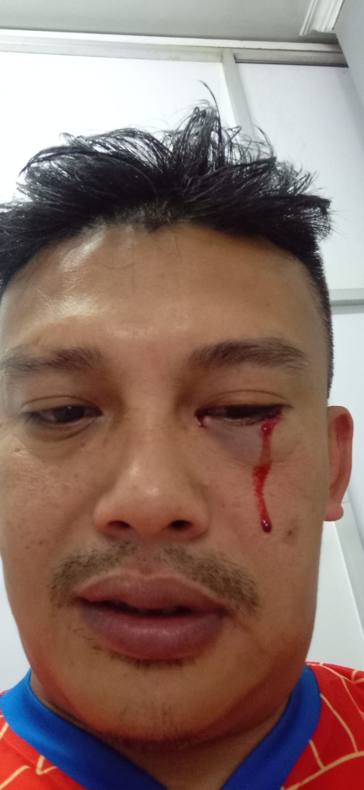 Husni Nursyaf, wartawan  Metro TV di Sumedang, korban penganiayaan