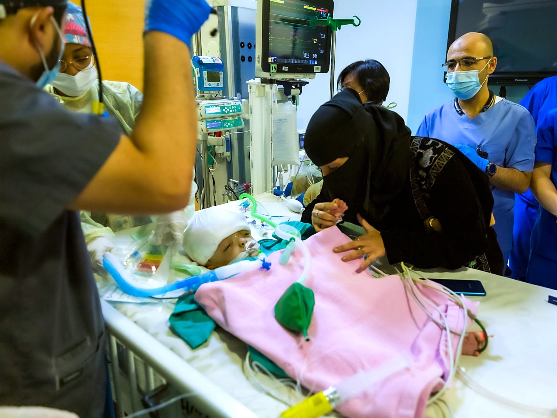 Ibu dari kembar siam Yaman memeriksa bayinya setelah pemisahan mereka oleh ahli bedah spesialis Saudi di suatu rumah sakit, Riyadh.