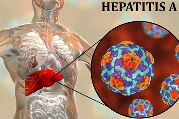 ilustrasi hepatitis