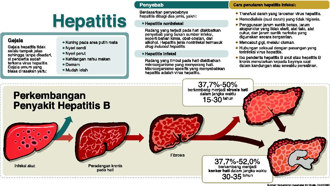 Hepatitis misterius yang muncul saat ini disebut akut karena perburukannya terjadi dalam waktu cepat.