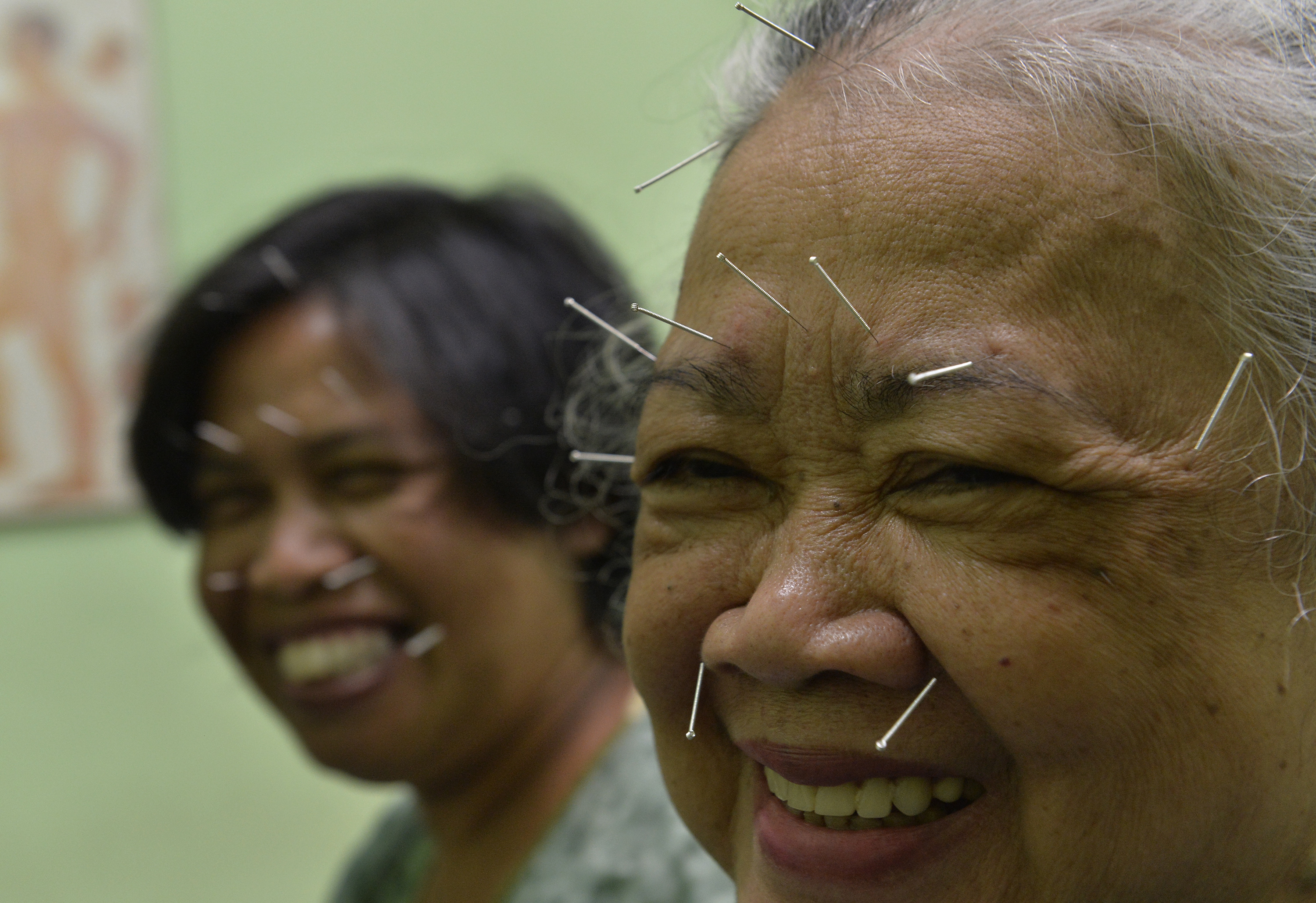 Dua pasien menjalani pengobatan dengan metode akupuntur (tusuk jarum) di Klinik Husada Mitra Selaras, Depok, Jabar.