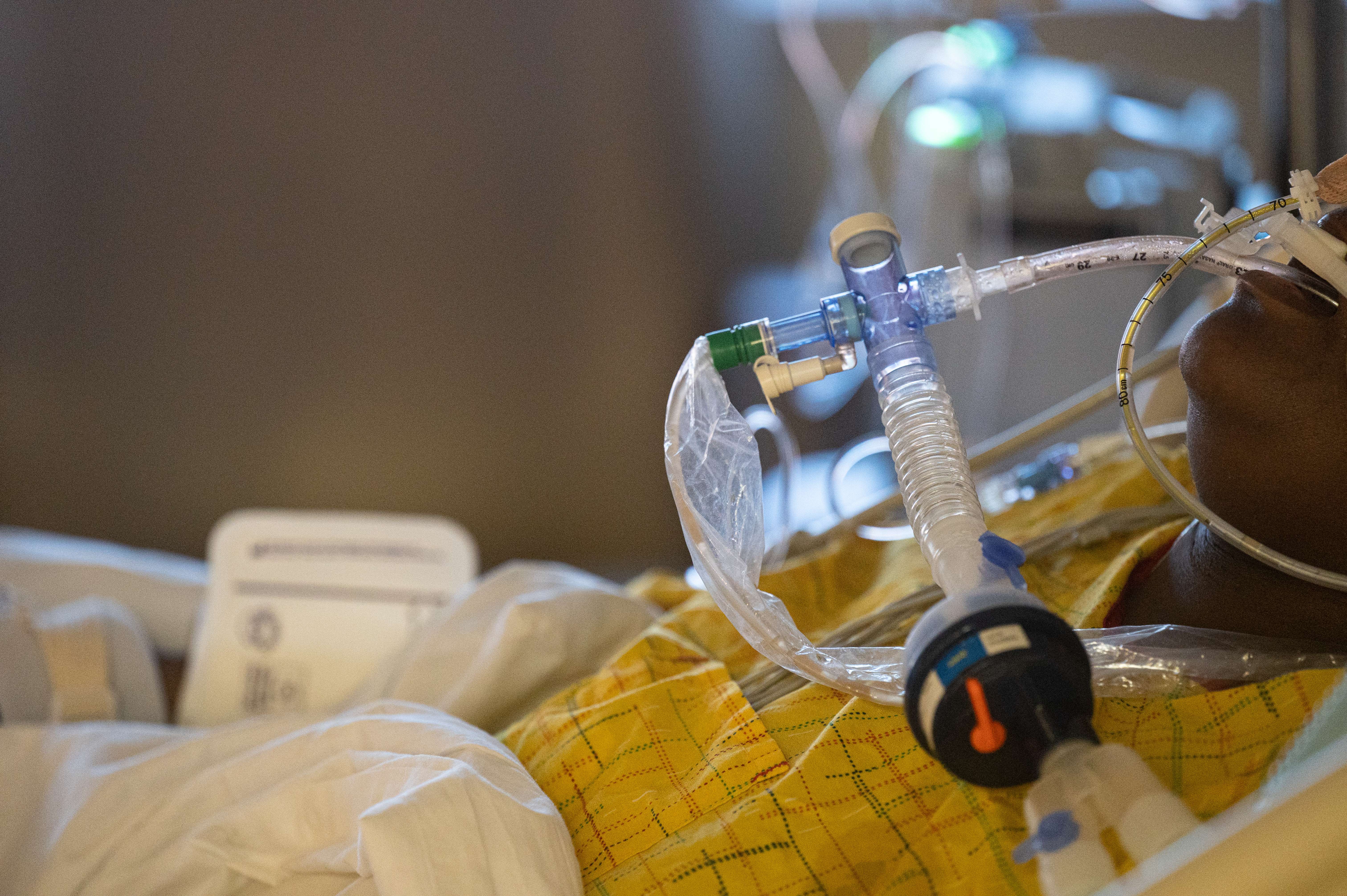 Seorang pasien covid-19 dipasangkan ventilator di ruang ICU sebuah rumah sakit di Indiana, Amerika Serikat.