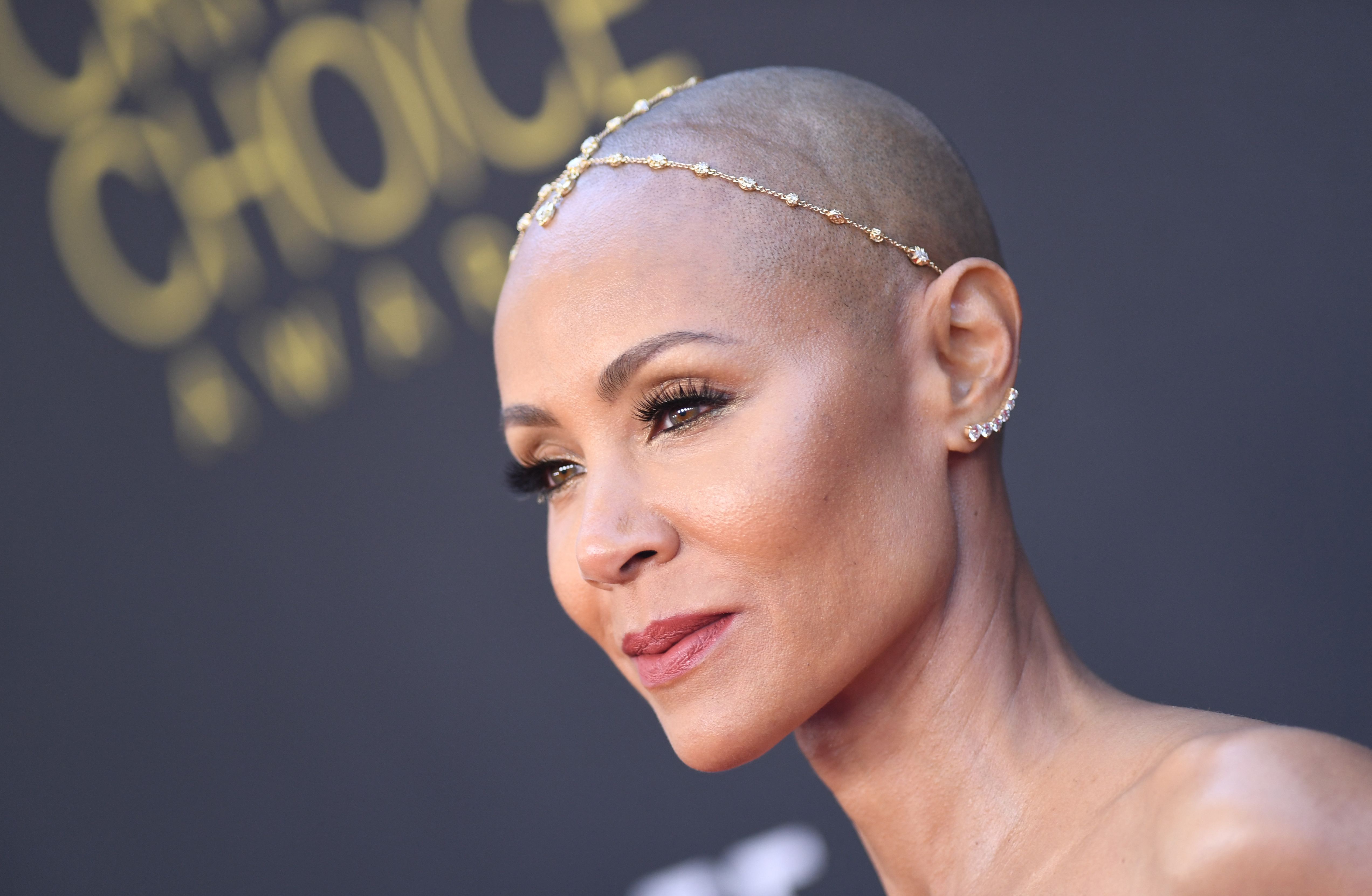 Aktris AS Jada Pinkett Smith yang menderita alopecia.
