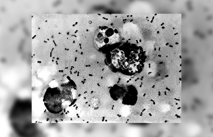 Bakteri pes diambil dari seorang pasien pada tahun 2003. 