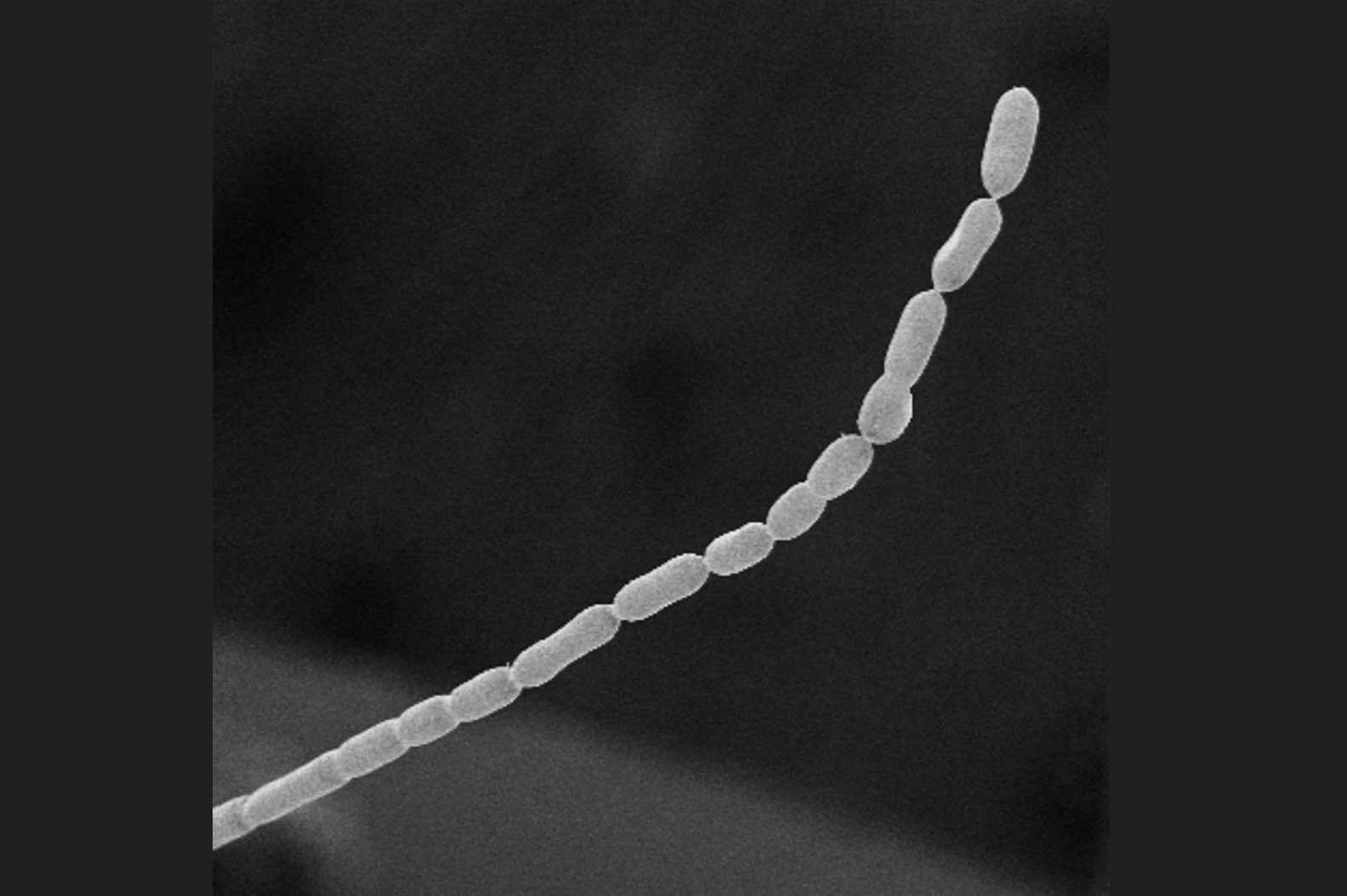 Foto yang diambil dari mikroskop 3D dari bakteri raksasa Thiomargarita magnifica