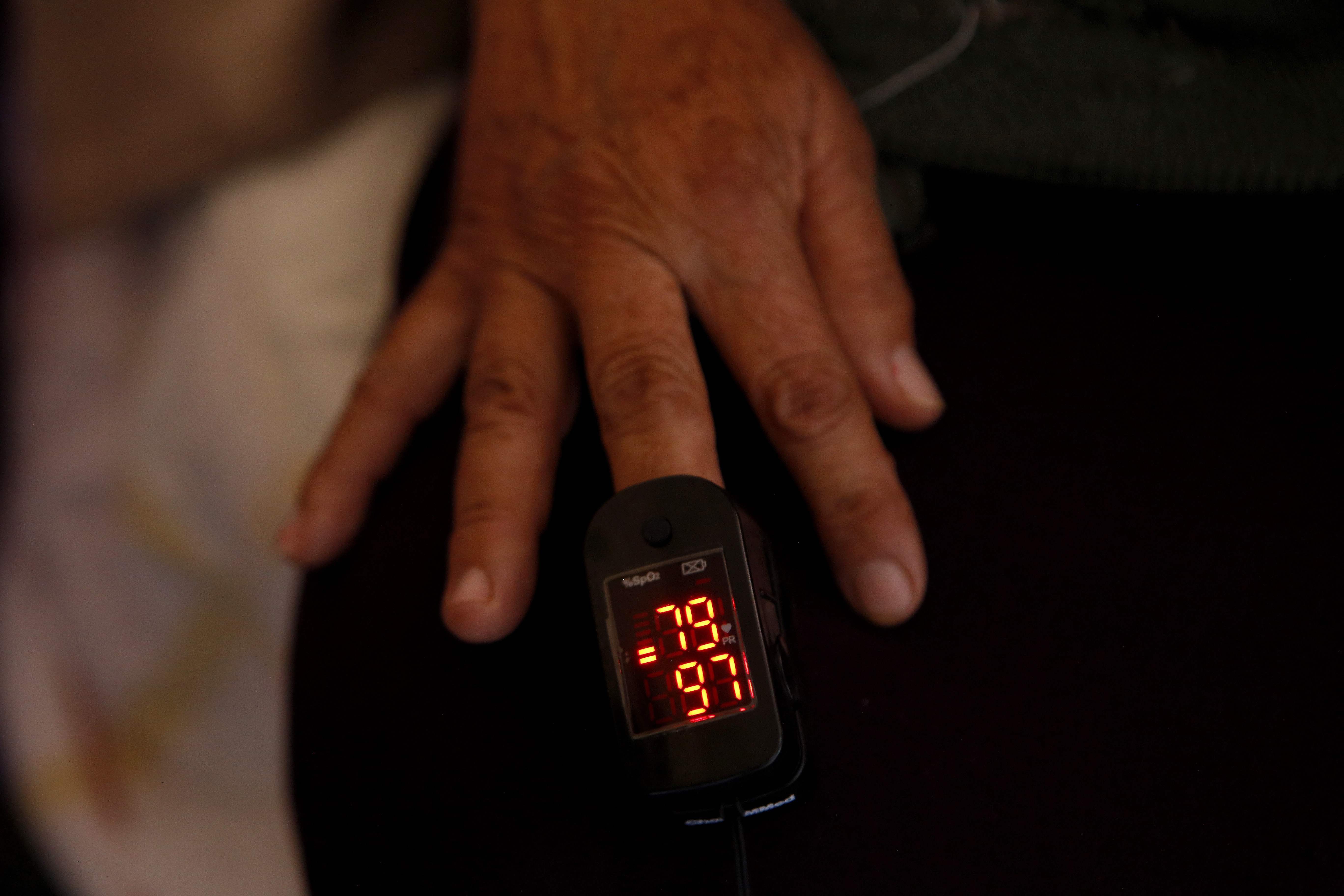 Seorang pasien diperiksa kadar oksigen dalam darahnya menggunakan Oksimeter di Meksiko.