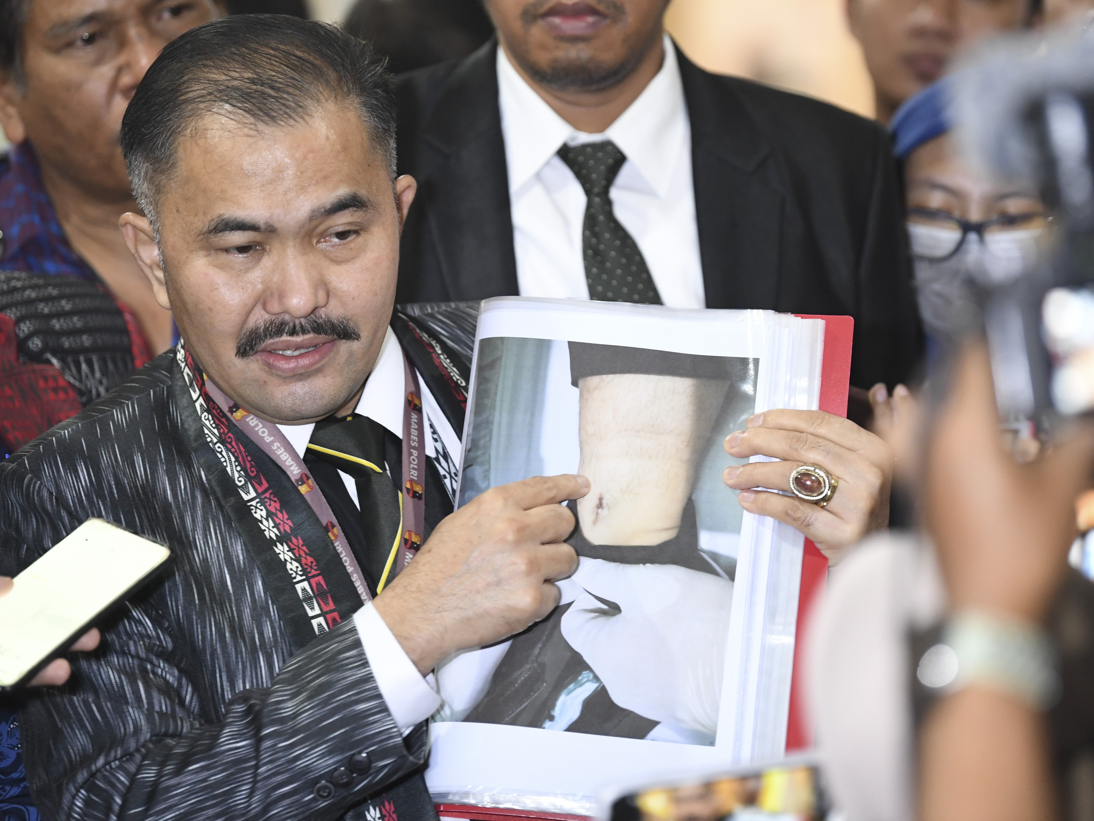 Kuasa hukum keluarga Brigadir J, korban peristiwa dugaan baku tembak antaranggota Polisi di rumah dinas Kepala Divisi Propam Polri.