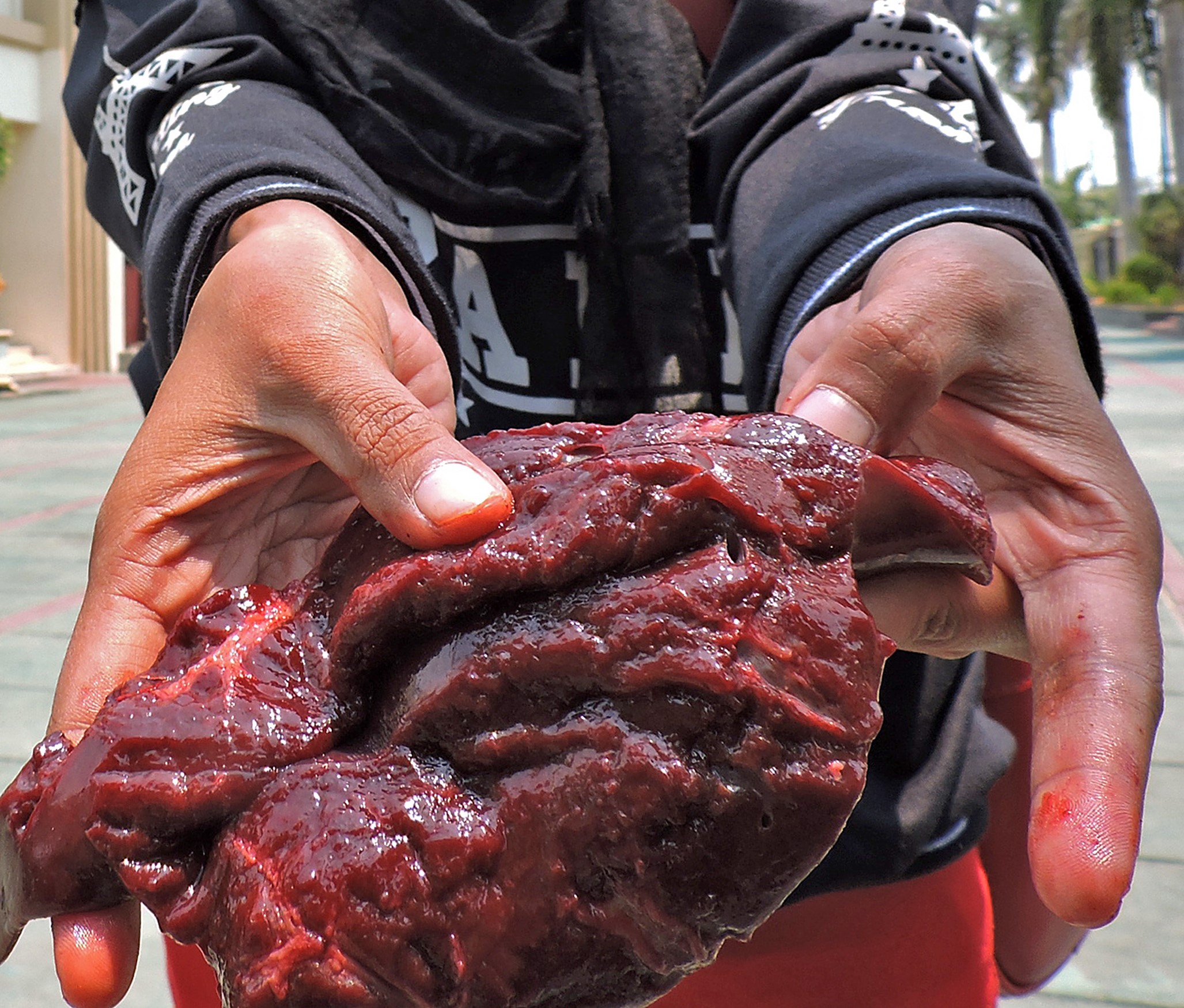 Ilustrasi jeroan yang mengandung cacing