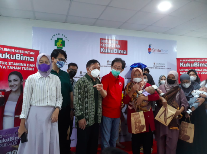 Setiap Tahun ada 8.000 Bayi Sumbing Bibir Lahir di Indonesia