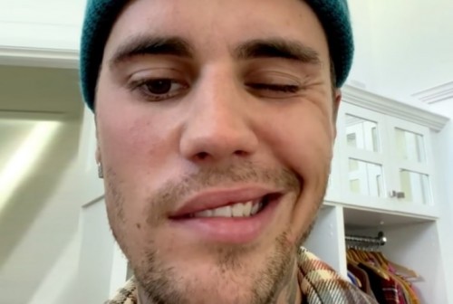 Justin Bieber saat mengumumkan dirinya menderita Ramsay Hunt Syndrome