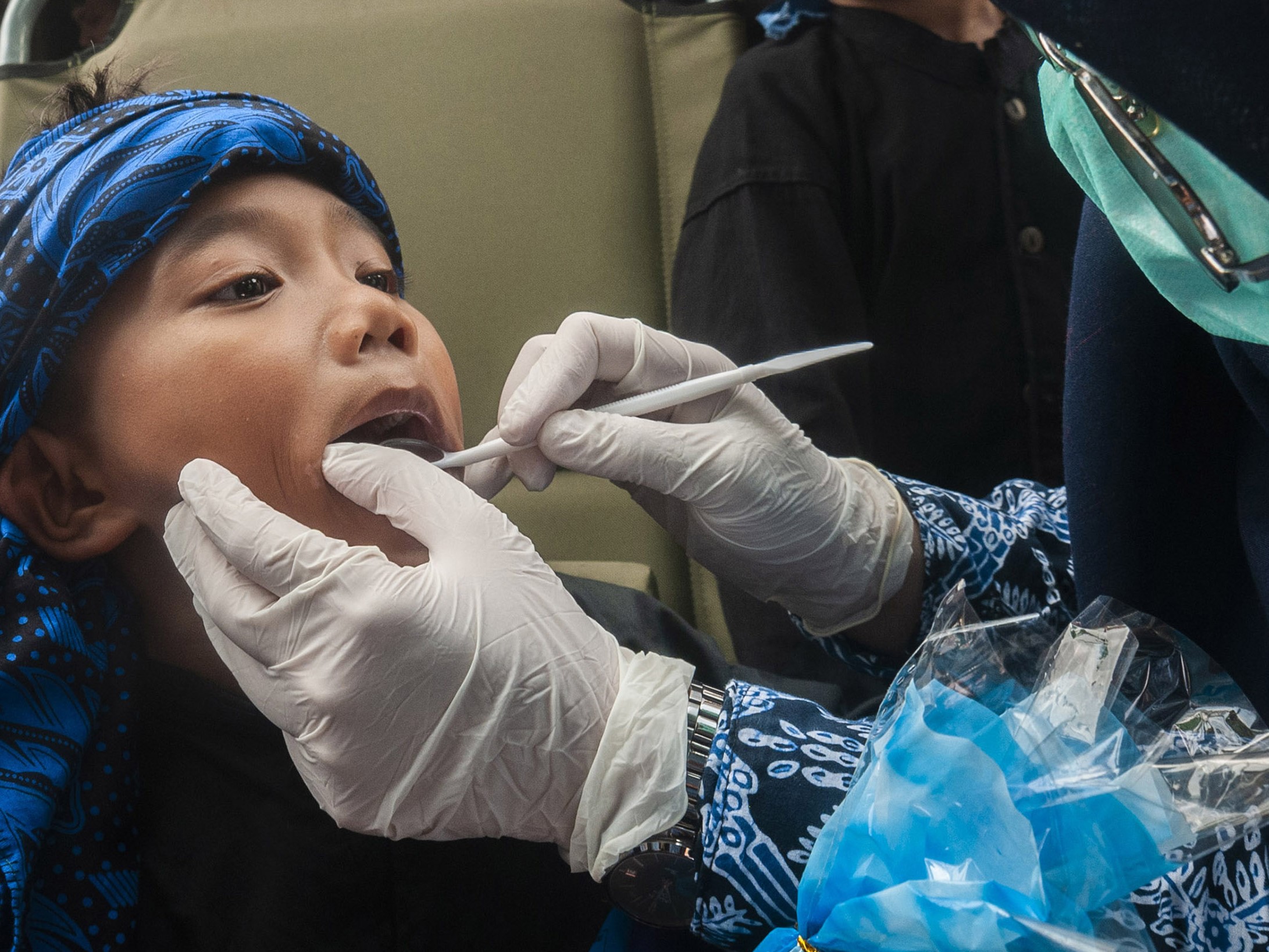 Dokter memeriksa gigi anak Suku Baduy saat Baksos TNI di Kampung Kaduketug, Lebak, Banten, Kamis (4/8/2022).
