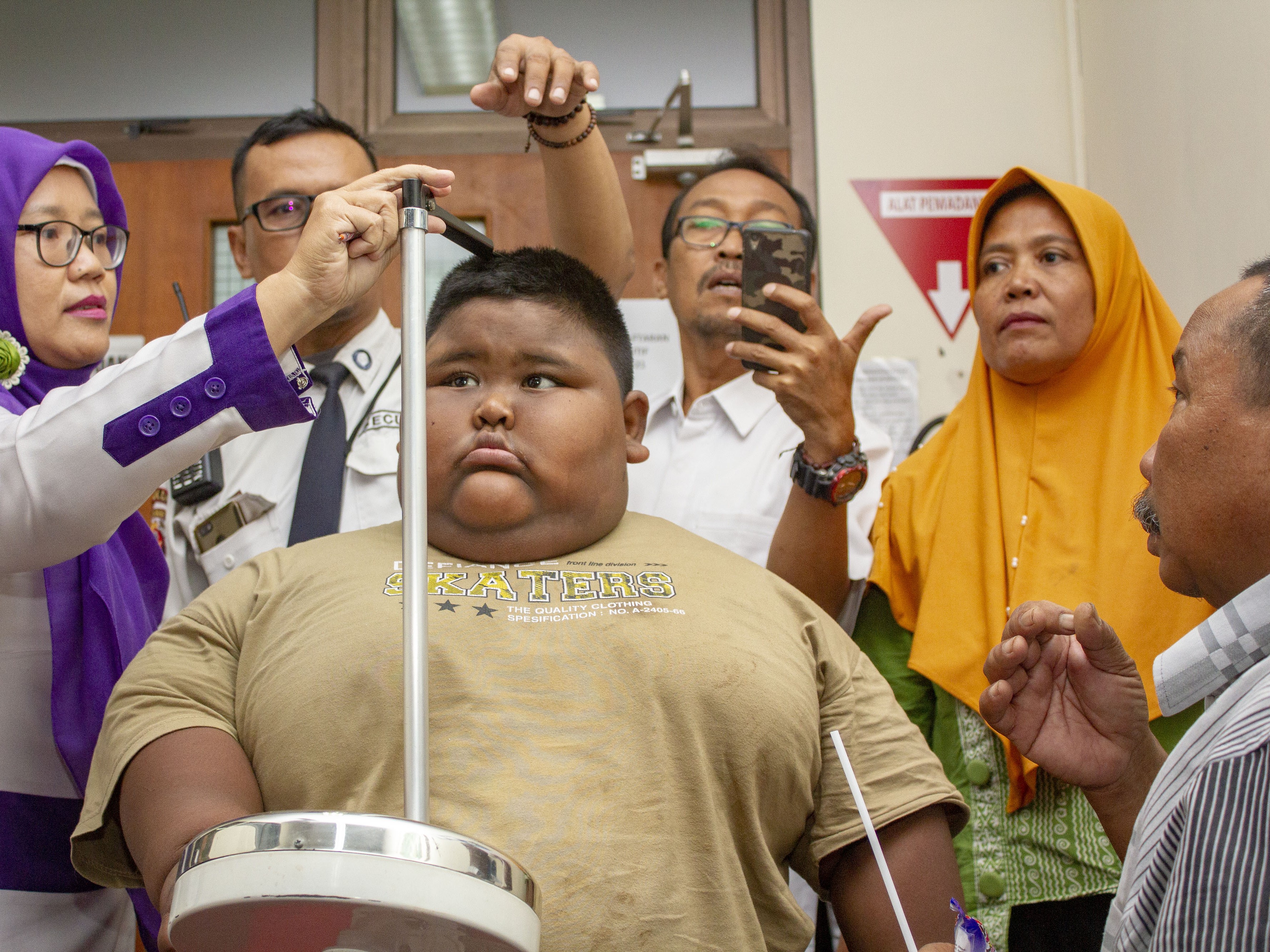 Bahaya akibat Asupan Gula Berlebihan kepada Anak